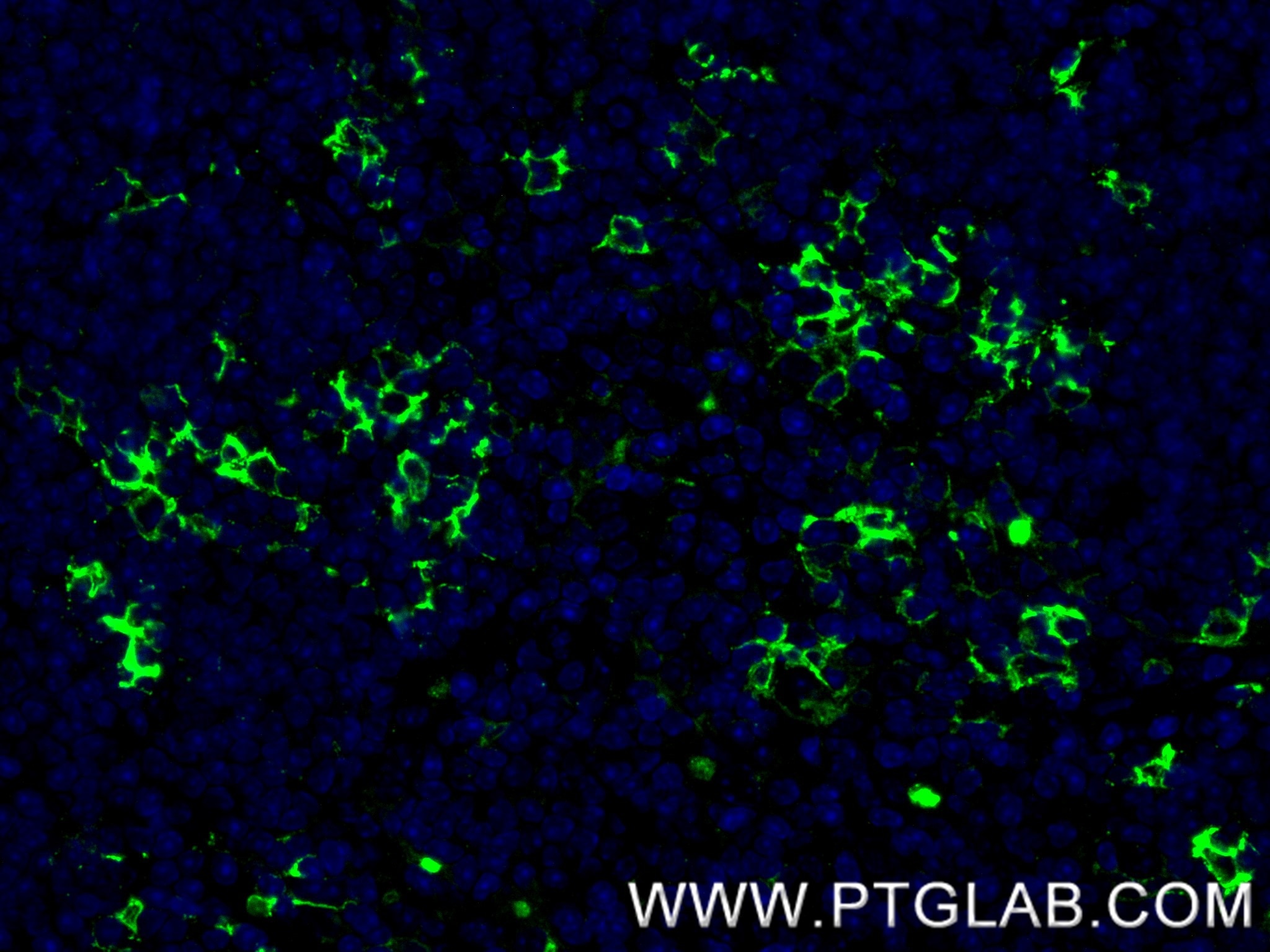 Immunofluorescence (IF) / fluorescent staining of mouse thymus tissue using CD23 Recombinant monoclonal antibody (84212-3-RR)