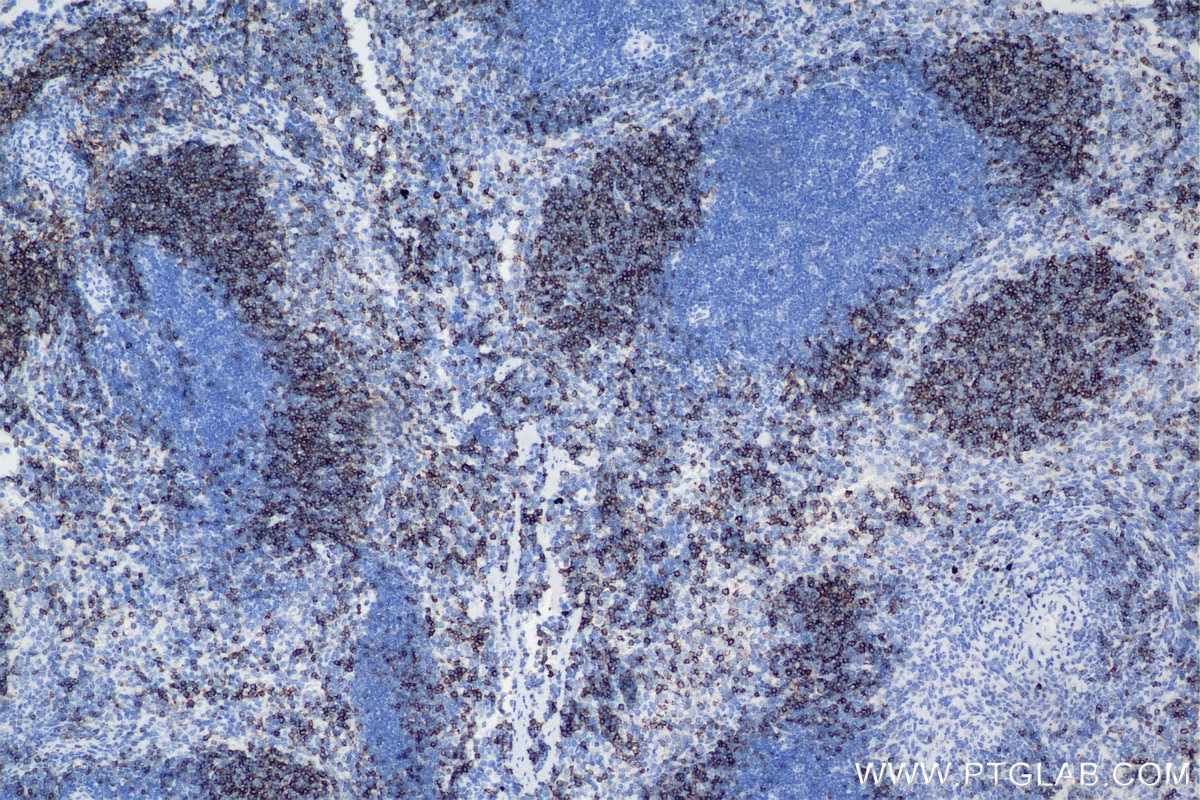 Immunohistochemistry (IHC) staining of mouse spleen tissue using CD23/Fc epsilon RII Recombinant antibody (84212-3-RR)