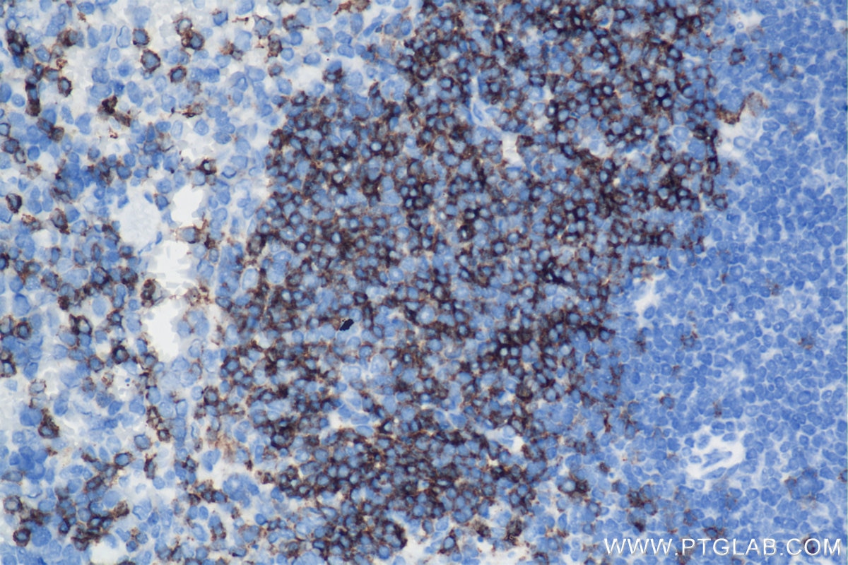 Immunohistochemistry (IHC) staining of mouse spleen tissue using CD23/Fc epsilon RII Recombinant antibody (84212-3-RR)