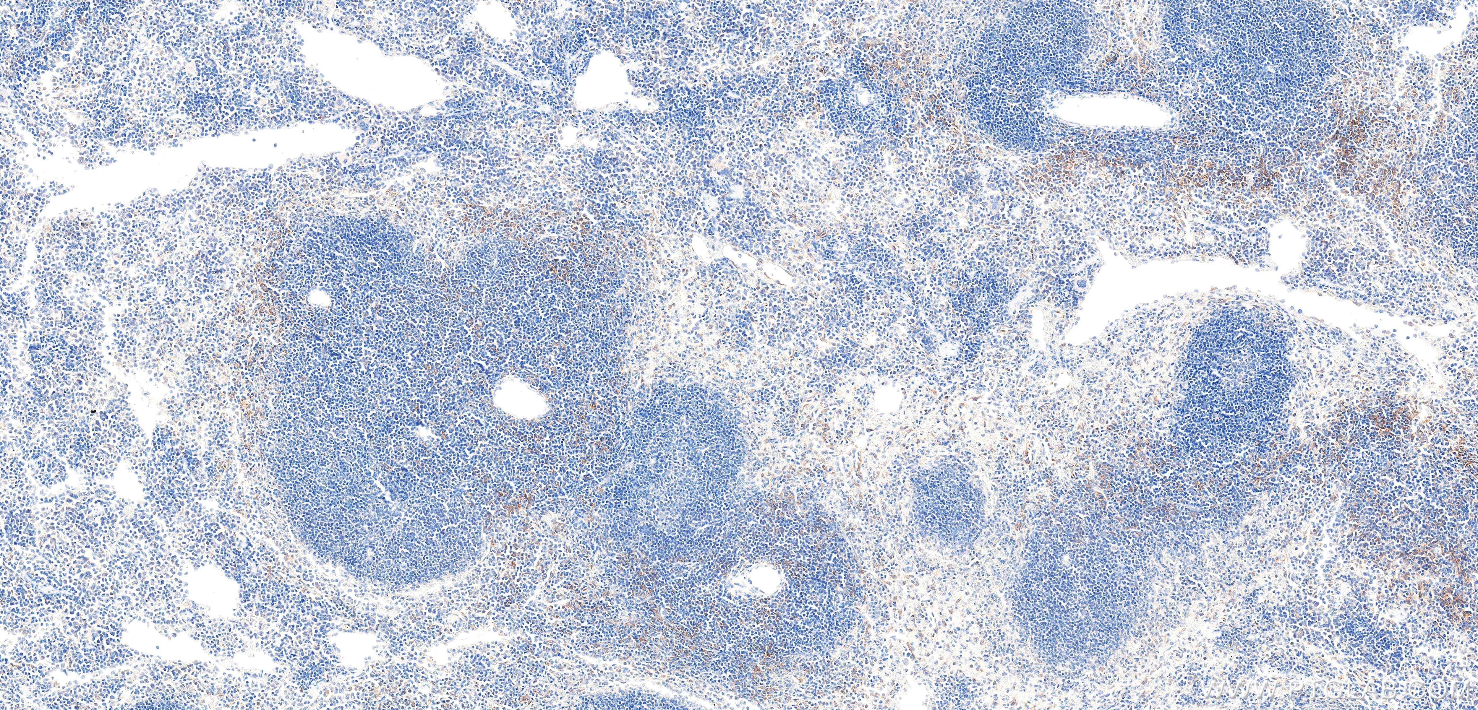 Immunohistochemistry (IHC) staining of mouse spleen tissue using CD232/PLXNC1 Recombinant monoclonal antibody (87759-2-RR)