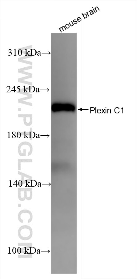 Western Blot (WB) analysis of various lysates using CD232/PLXNC1 Recombinant monoclonal antibody (87759-2-RR)