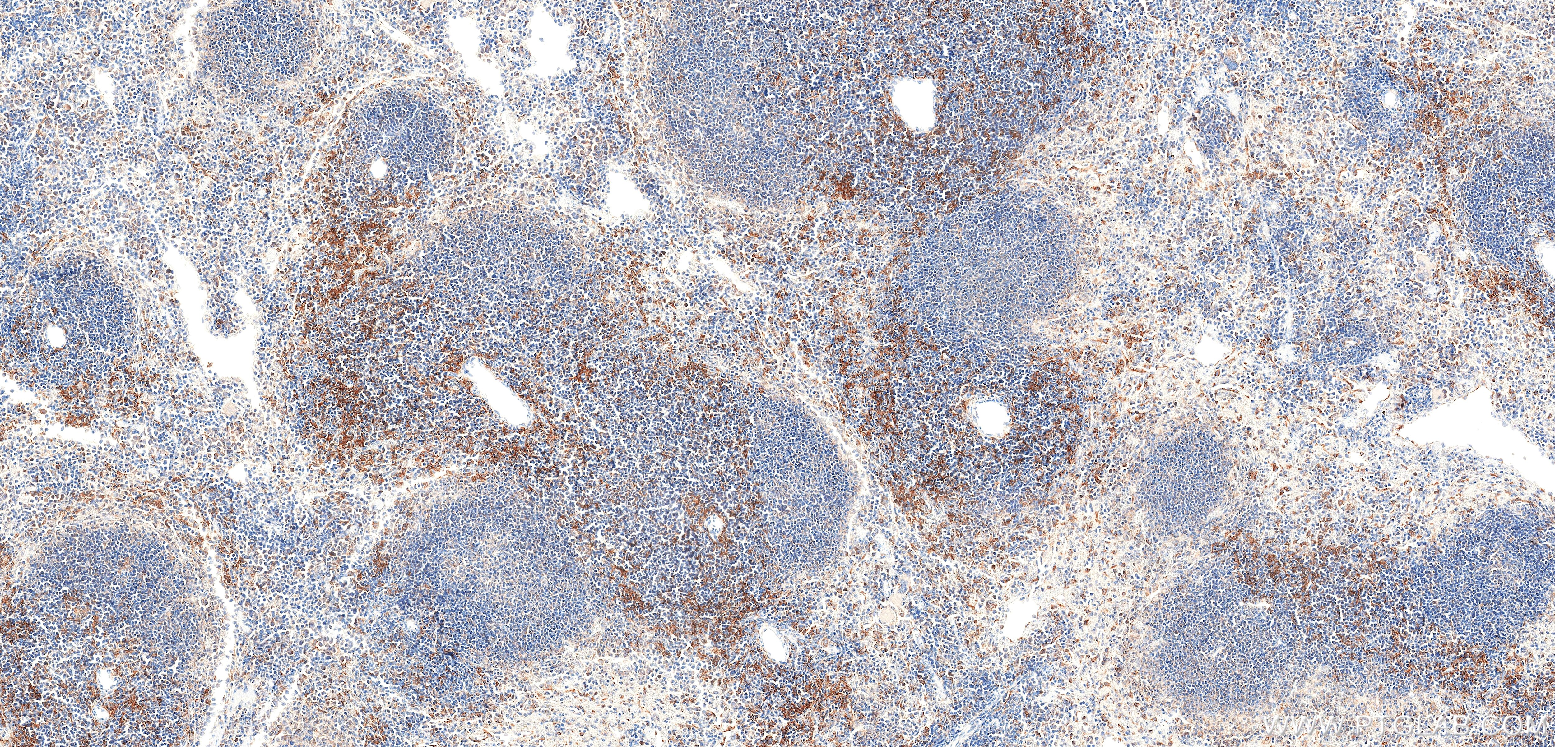 Immunohistochemistry (IHC) staining of mouse spleen tissue using CD232/PLXNC1 Recombinant monoclonal antibody (87759-3-RR)