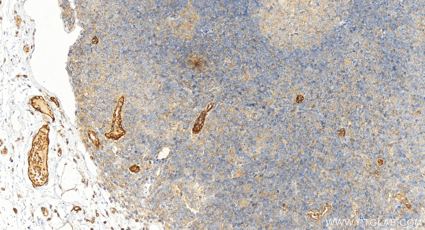 Immunohistochemistry (IHC) staining of human colon tissue using DARC Polyclonal antibody (55185-1-AP)