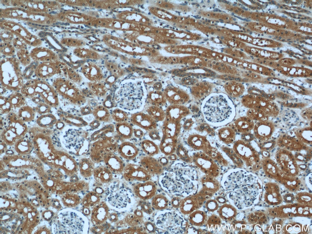 Immunohistochemistry (IHC) staining of human kidney tissue using DARC Polyclonal antibody (55185-1-AP)