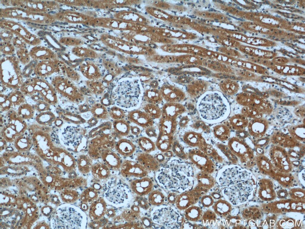 IHC staining of human kidney using 55185-1-AP