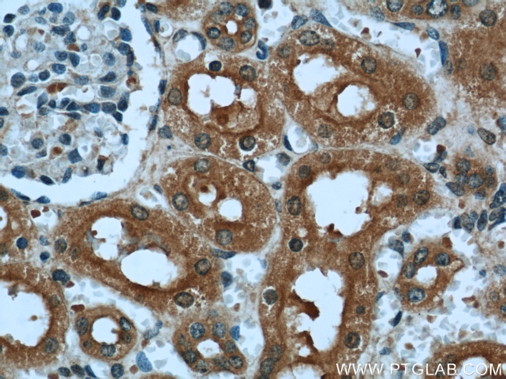 Immunohistochemistry (IHC) staining of human kidney tissue using DARC Polyclonal antibody (55185-1-AP)