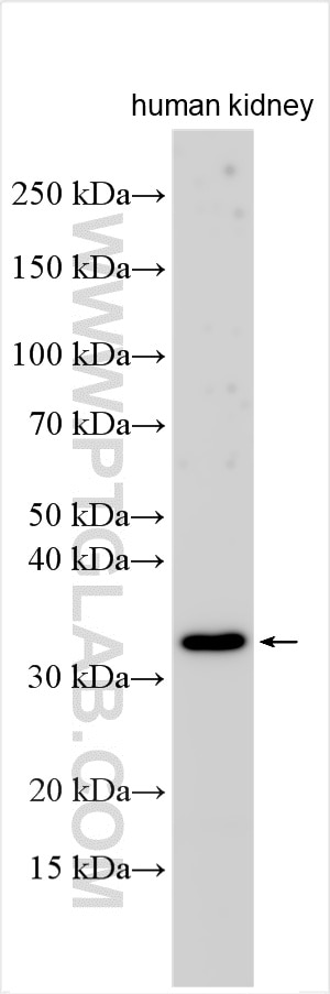 Western Blot (WB) analysis of various lysates using DARC Polyclonal antibody (55185-1-AP)