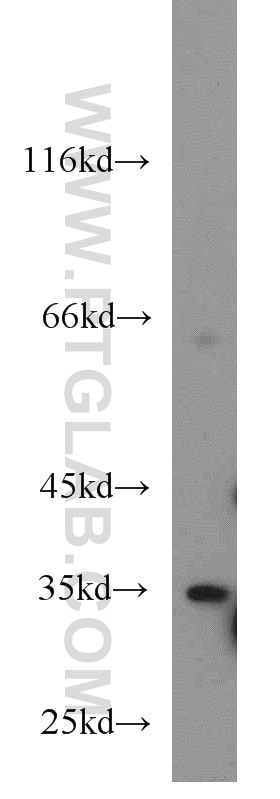 Western Blot (WB) analysis of K-562 cells using DARC Polyclonal antibody (55185-1-AP)