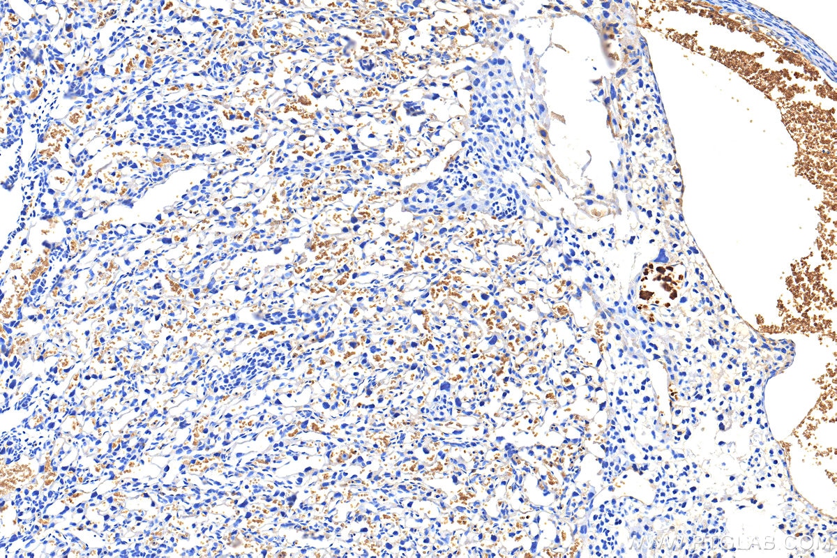 Immunohistochemistry (IHC) staining of mouse placenta tissue using Glycophorin A/CD235a Polyclonal antibody (32339-1-AP)