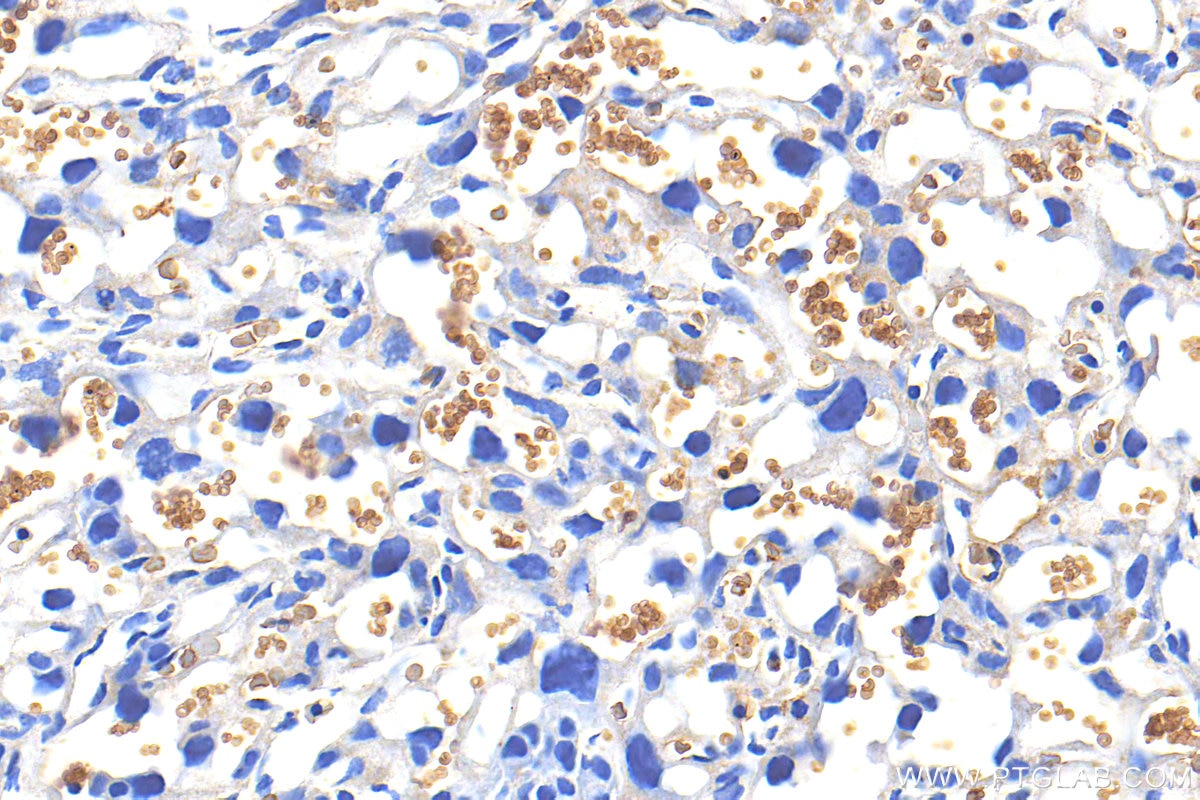 Immunohistochemistry (IHC) staining of mouse placenta tissue using Glycophorin A/CD235a Polyclonal antibody (32339-1-AP)