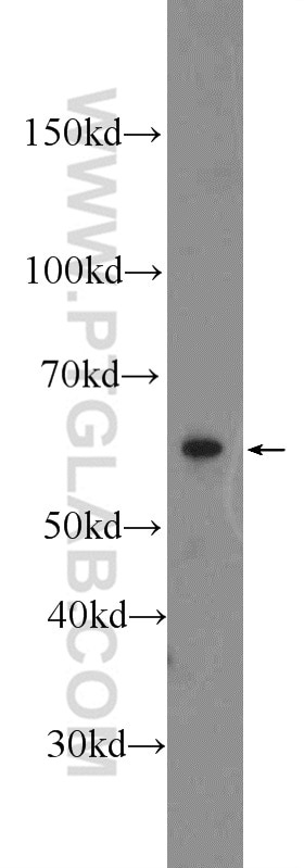 Western Blot (WB) analysis of rat spleen tissue using CD24 Polyclonal antibody (10600-1-AP)