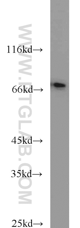 Western Blot (WB) analysis of mouse brain tissue using CD24 Polyclonal antibody (10600-1-AP)