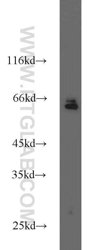 Western Blot (WB) analysis of HeLa cells using CD24 Polyclonal antibody (10600-1-AP)