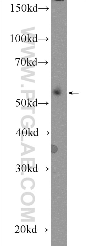 Western Blot (WB) analysis of mouse spleen tissue using CD24 Polyclonal antibody (18330-1-AP)