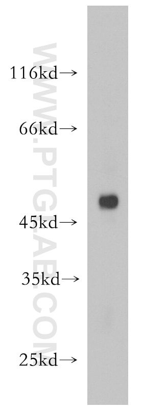 Western Blot (WB) analysis of Raji cells using CD24 Polyclonal antibody (18330-1-AP)