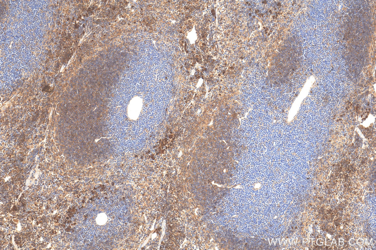 Immunohistochemistry (IHC) staining of mouse spleen tissue using CD24 Polyclonal antibody (32150-1-AP)