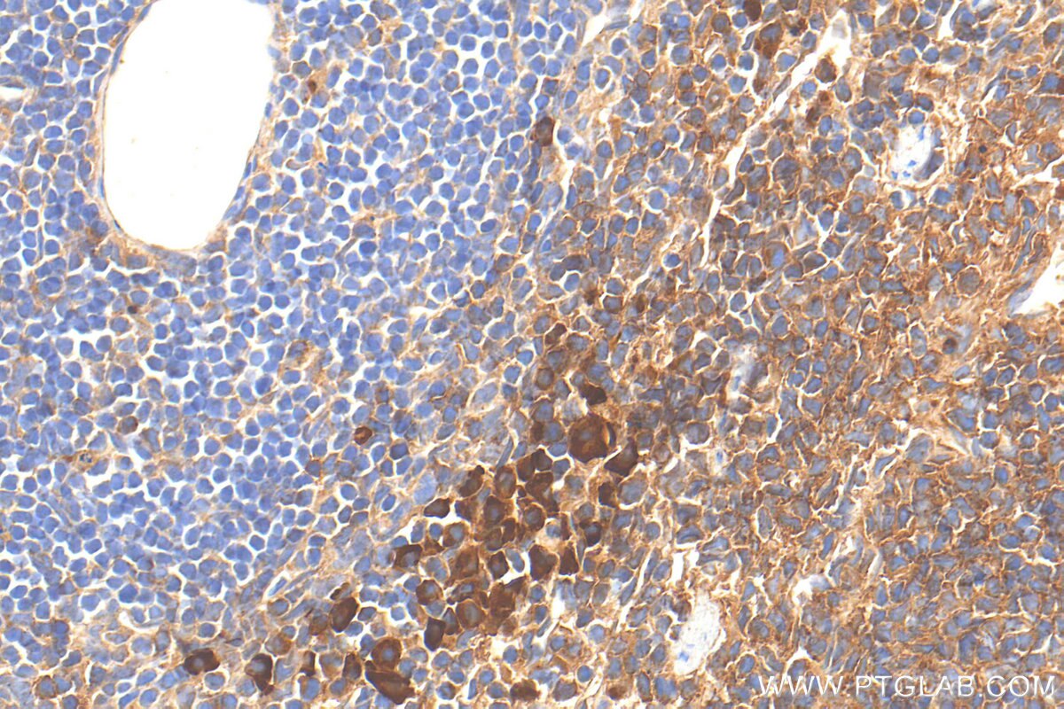 Immunohistochemistry (IHC) staining of mouse spleen tissue using CD24 Polyclonal antibody (32150-1-AP)