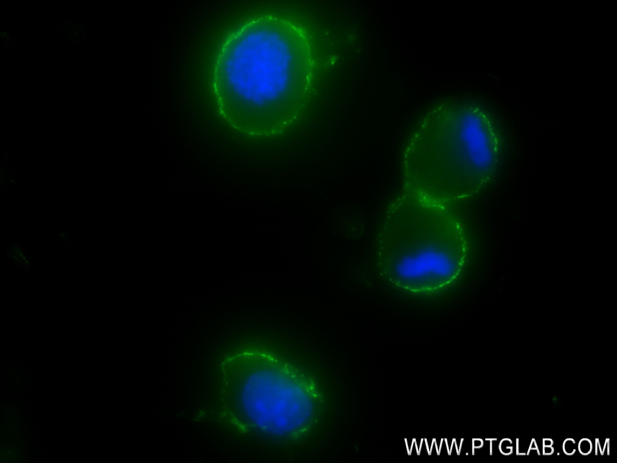 Immunofluorescence (IF) / fluorescent staining of Neuro-2a cells using CD24 Recombinant antibody (84342-5-RR)