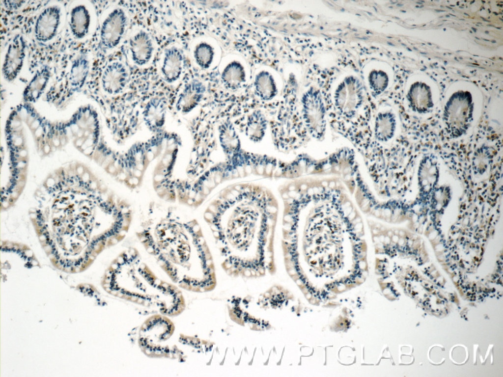 IHC staining of human small intestine using 16677-1-AP