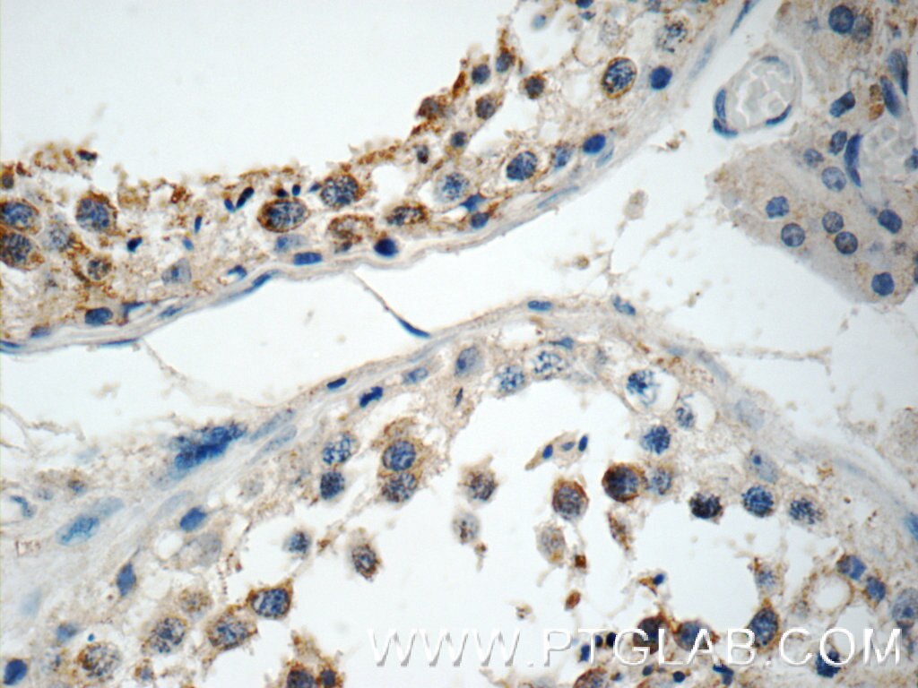 IHC staining of human testis using 16677-1-AP