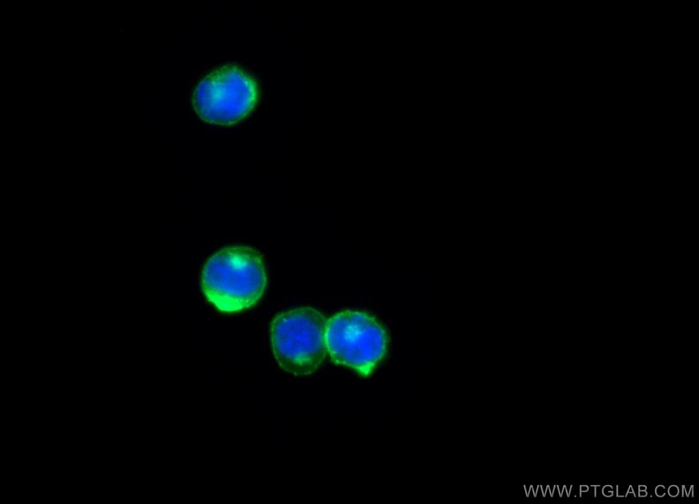 Immunofluorescence (IF) / fluorescent staining of Jurkat cells using CD247 Polyclonal antibody (12837-2-AP)