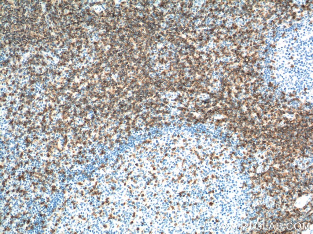 CD247 Polyclonal antibody