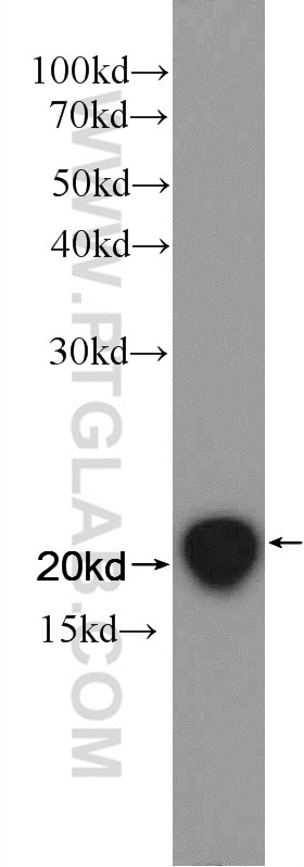 WB analysis of mouse spleen using 12837-2-AP