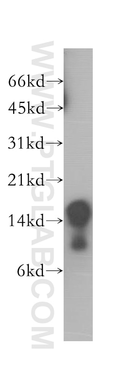 Western Blot (WB) analysis of human spleen tissue using CD247 Polyclonal antibody (12837-2-AP)