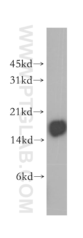 Western Blot (WB) analysis of Jurkat cells using CD247 Polyclonal antibody (12837-2-AP)