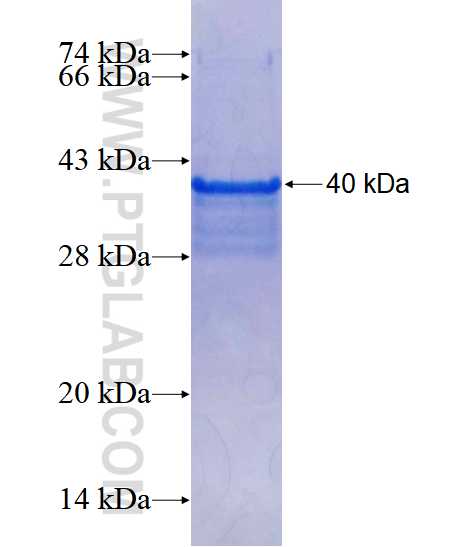CD247 fusion protein Ag3889 SDS-PAGE