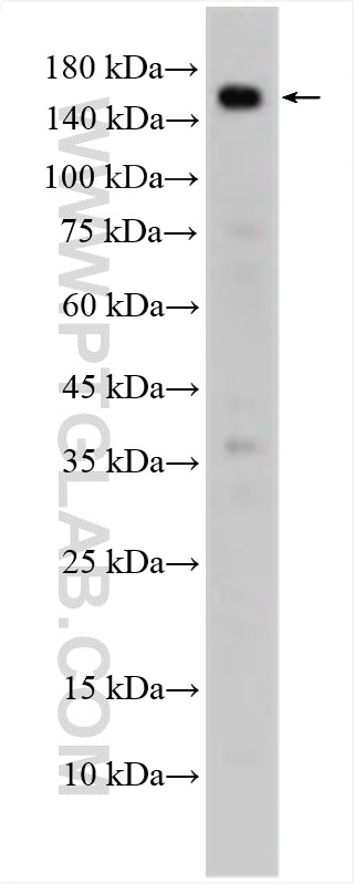 Western Blot (WB) analysis of HUVEC cells using TEM1 Polyclonal antibody (18160-1-AP)