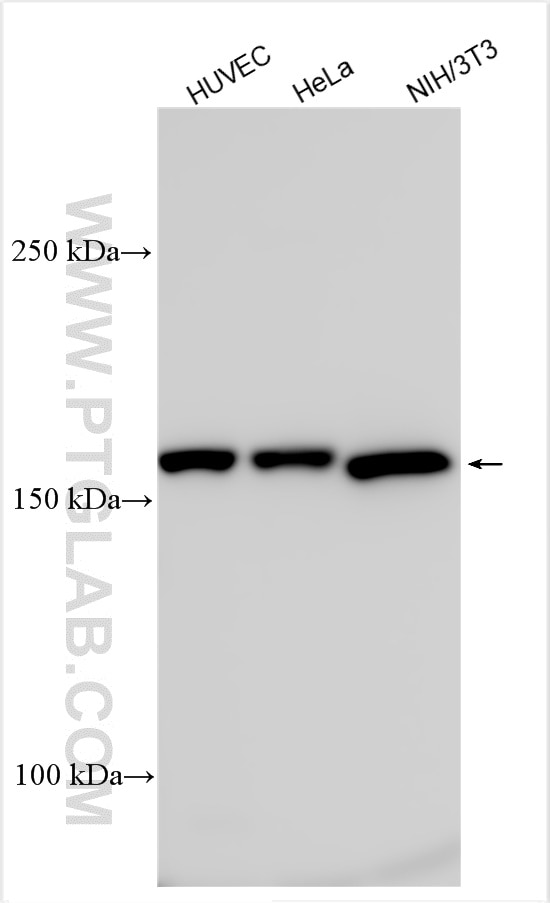 Western Blot (WB) analysis of various lysates using TEM1 Polyclonal antibody (18160-1-AP)