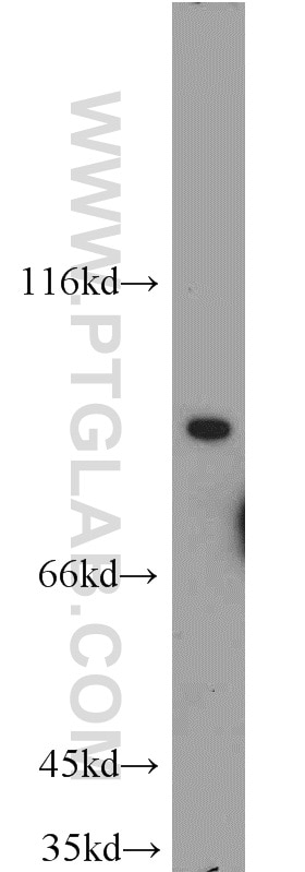 Western Blot (WB) analysis of COLO 320 cells using TEM1 Polyclonal antibody (18160-1-AP)