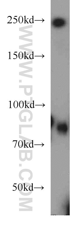 Western Blot (WB) analysis of NIH/3T3 cells using TEM1 Polyclonal antibody (18160-1-AP)