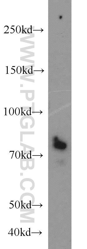 Western Blot (WB) analysis of SH-SY5Y cells using TEM1 Polyclonal antibody (18160-1-AP)