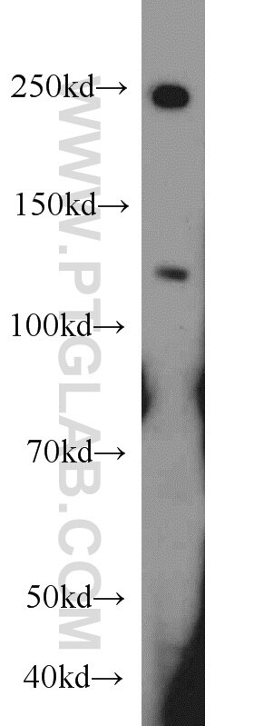 TEM1 Polyclonal antibody