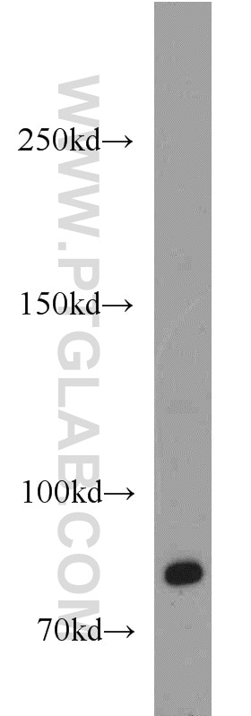 Western Blot (WB) analysis of HeLa cells using TEM1 Polyclonal antibody (18160-1-AP)