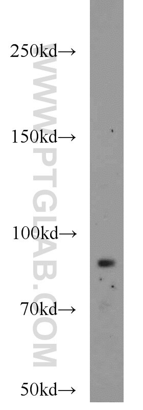 Western Blot (WB) analysis of HEK-293 cells using TEM1 Polyclonal antibody (18160-1-AP)