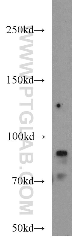 Western Blot (WB) analysis of A375 cells using TEM1 Polyclonal antibody (18160-1-AP)