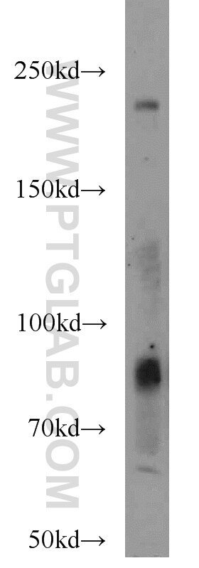 Western Blot (WB) analysis of mouse stomach tissue using TEM1 Polyclonal antibody (18160-1-AP)