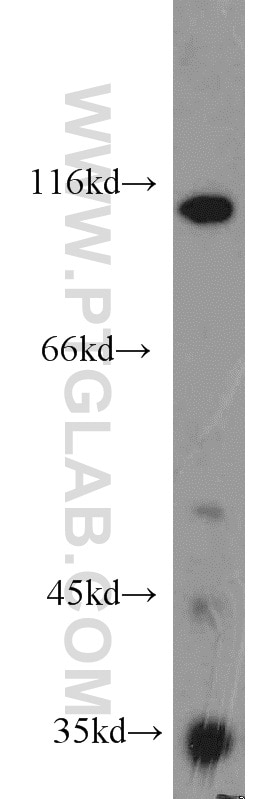 Western Blot (WB) analysis of mouse heart tissue using TEM1 Polyclonal antibody (18160-1-AP)