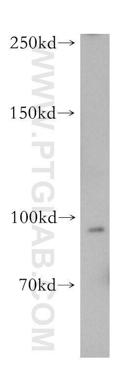 Western Blot (WB) analysis of mouse colon tissue using TEM1 Polyclonal antibody (18160-1-AP)