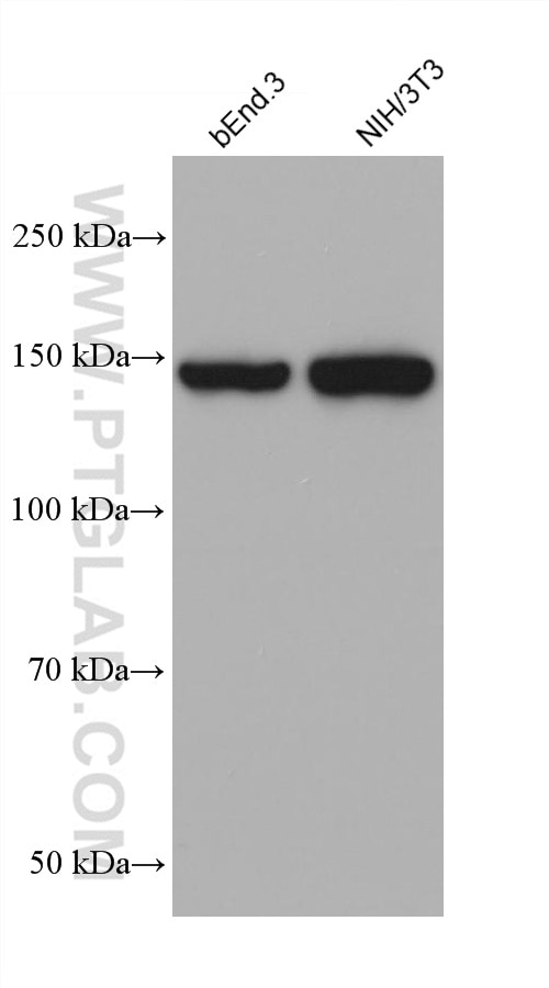 Western Blot (WB) analysis of various lysates using TEM1 Monoclonal antibody (60170-1-Ig)