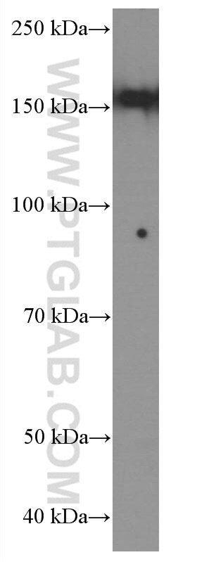 Western Blot (WB) analysis of COLO 320 cells using TEM1 Monoclonal antibody (60170-1-Ig)