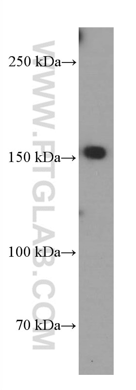 Western Blot (WB) analysis of HUVEC cells using TEM1 Monoclonal antibody (60170-1-Ig)