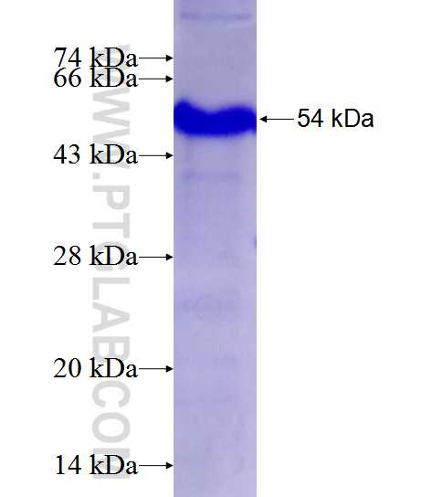 CD248 fusion protein Ag12990 SDS-PAGE