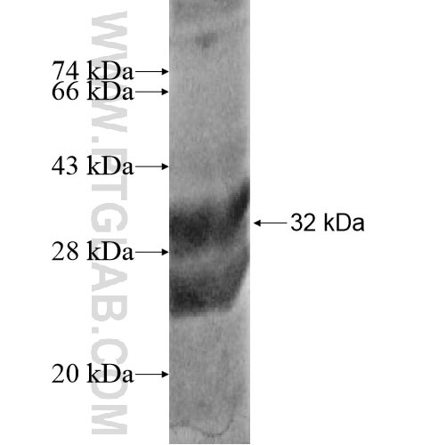 CD248 fusion protein Ag13354 SDS-PAGE
