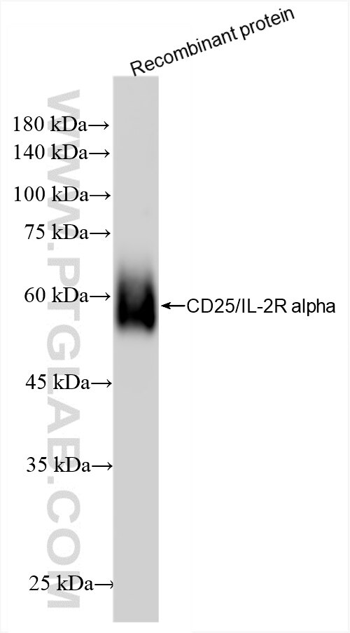 Western Blot (WB) analysis of various lysates using CD25/IL-2R alpha Recombinant antibody (86213-1-RR)