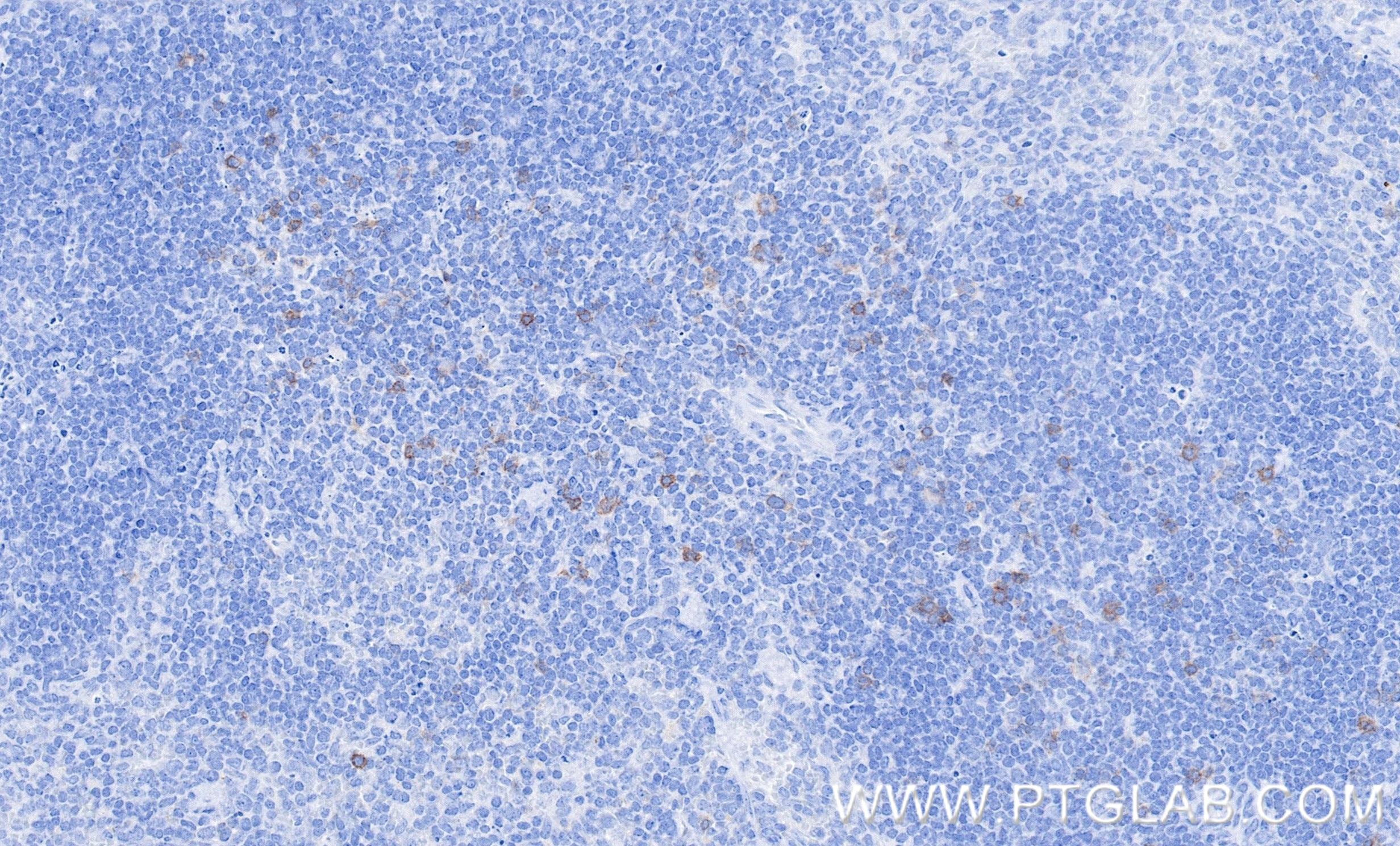 IHC staining of mouse spleen using 98288-1-RR Immunohistochemistry (IHC) staining of mouse spleen tissue using Anti-Mouse CD25/IL-2RA Rabbit Recombinant Antibody (98288-1-RR)