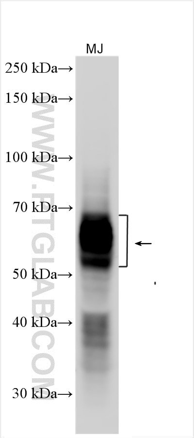 Western Blot (WB) analysis of various lysates using CD25/IL2RA Polyclonal antibody (30449-1-AP)